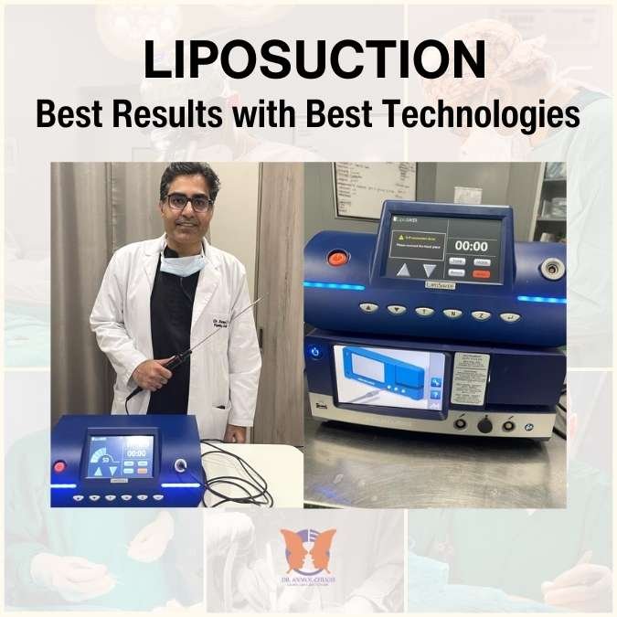 Dr Anmol Chugh-Liposuction Surgeon in Delhi NCR